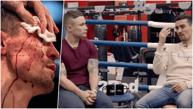 Ahead of trickiest test in boxing, Anthony Crolla recalls burglar attack which could have killed him Ahead of trickiest test in boxing, Anthony Crolla recalls burglar attack which could have killed him
