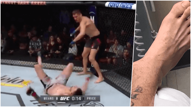 Tim Means suffers gruesome ankle injury after brutal knockout punch Tim Means suffers gruesome ankle injury after brutal knockout punch
