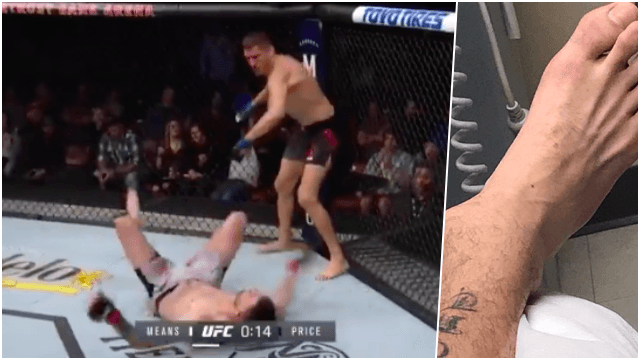 Tim Means suffers gruesome ankle injury after brutal knockout punch Tim Means suffers gruesome ankle injury after brutal knockout punch