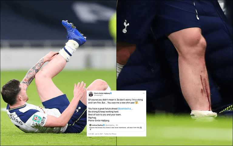 Pierre-Emile Hojbjerg makes peace with Josh Dasilva after horror tackle in Carabao Cup Pierre-Emile Hojbjerg makes peace with Josh Dasilva after horror tackle in Carabao Cup