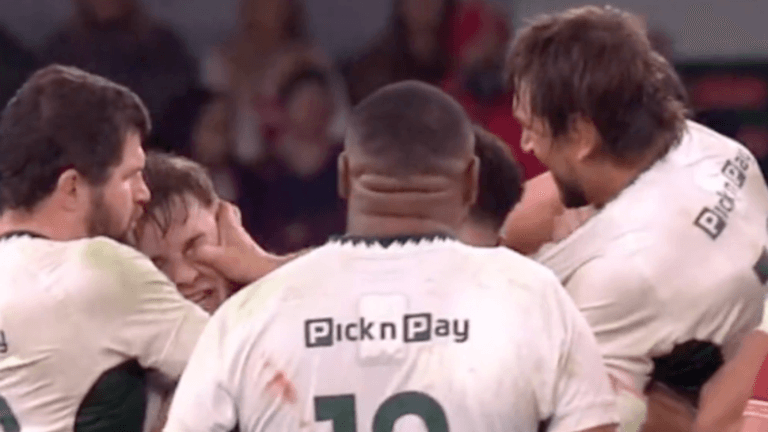South Africa great Etzebeth sent off for disgraceful eye gouge in Wales hammering South Africa great Etzebeth sent off for disgraceful eye gouge in Wales hammering