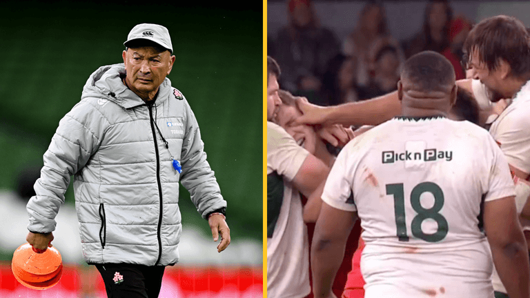 Eddie Jones bizarrely refers Etzebeth gouge as a ‘minor incident’ Eddie Jones bizarrely refers Etzebeth gouge as a ‘minor incident’