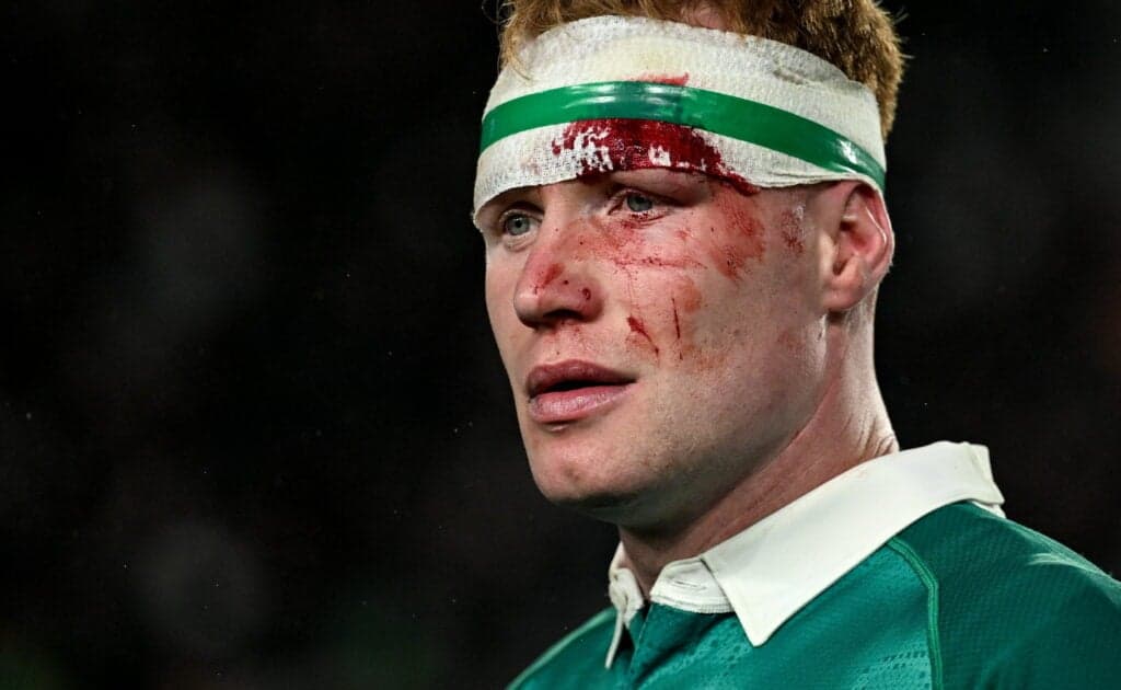 New Zealand media paints sorry picture for Ireland after heavy loss