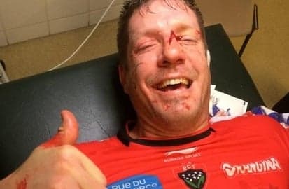 You can now add ‘horribly mangled finger’ to the lengthy list of Bakkies Botha injuries You can now add ‘horribly mangled finger’ to the lengthy list of Bakkies Botha injuries