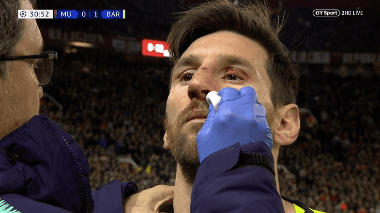 Chris Smalling breaks Lionel Messi’s nose, retirement announcement expected tomorrow Chris Smalling breaks Lionel Messi’s nose, retirement announcement expected tomorrow