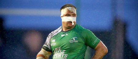 Pics: Nathan White got his face badly busted up playing an Interprovincial A match today