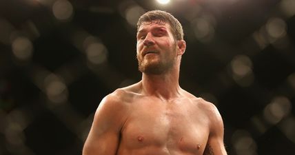 PIC: Michael Bisping lost a huge chunk of his big toe in victory over Thales Leites (GRAPHIC)