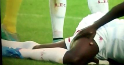 WATCH: Cumbersome Simon Mignolet stands on an already injured Kolo Toure