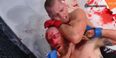 [GRAPHIC] Bellator 147 produces most gruesome rear-naked choke submission you will ever see