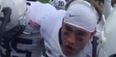 VIDEO: College footballer’s macho posturing leaves his face a bloody mess (NSFW)