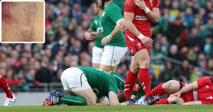 PIC: Brian O’Driscoll shows what happens to your arse when Scott Williams hits you at 27 Gs