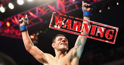 Rafael dos Anjos posts picture of his broken foot and it is downright nasty