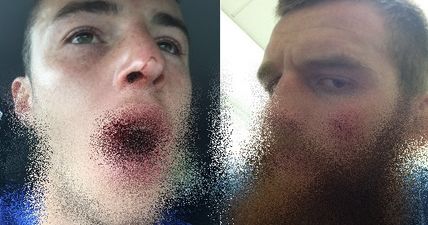 GRAPHIC: When professional rugby players’ heads clash, lips stand no chance whatsover