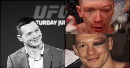 EXCLUSIVE: Joe Duffy on his unhealthy love of bloody battles in the Octagon