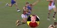 GRAPHIC: Aussie Rules starlet suffers gruesome double leg break by accidentally kicking himself