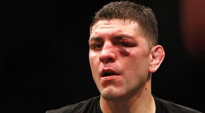 REPORT: Nick Diaz involved in Las Vegas nightclub brawl