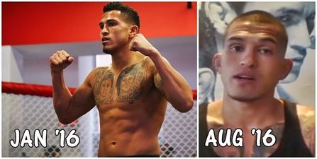 PICS: Anthony Pettis looking a shadow of himself ahead of UFC featherweight debut