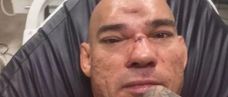 Despite fracturing skull in July, ‘Cyborg’ Santos intends to fight again before year is out