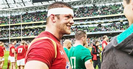 Anyone that doubts rugby players’ bloody-mindedness should know about Dan Lydiate’s most recent injury