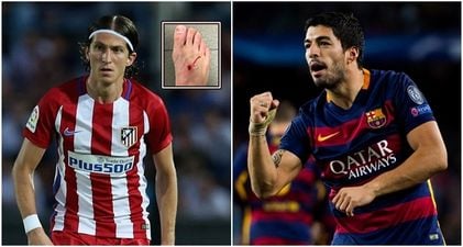 Luis Suarez leaves Filipe Luis with a nasty scar, and tells him to stop complaining