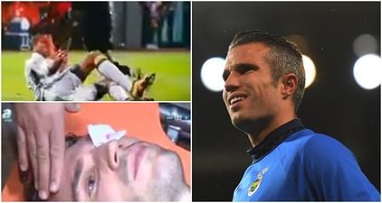 WATCH: Robin van Persie gives encouraging update after suffering gruesome eye injury