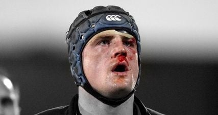 The actual medical reason why Jamie Heaslip is literally a freak of nature