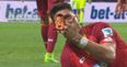 Bundesliga forward somehow didn’t freak out when he noticed finger injury