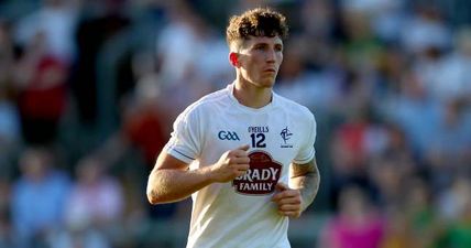 Kildare star has taken the ‘Championship haircut’ to a whole new planet