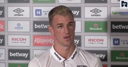 Everyone enjoyed Joe Hart’s cheeky explanation for his black eye