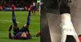 PSG dealt cruel blow as Brazilian team doctor issues Neymar injury update