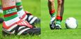 What exactly does your GAA sock choice say about you?