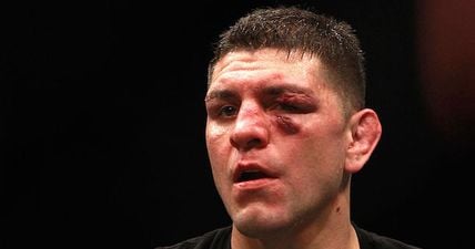 Nick Diaz arrested for alleged domestic violence incident