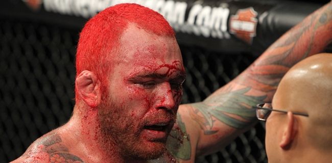 Chris Leben