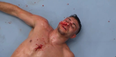 One-armed fighter Nick Newell cuts a dejected figure as UFC dream slips away