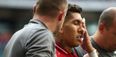 Roberto Firmino provides update following gruesome eye poke