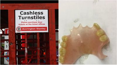 Accrington Stanley have lost one of their fans’ false teeth