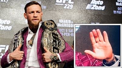 Conor McGregor explains how he damaged his finger ahead of UFC return