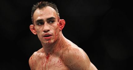 Tony Ferguson’s win bonus for defeating Anthony Pettis is a joke