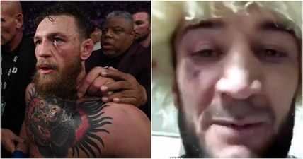 Khabib’s cousin shares images of damage Conor McGregor inflicted