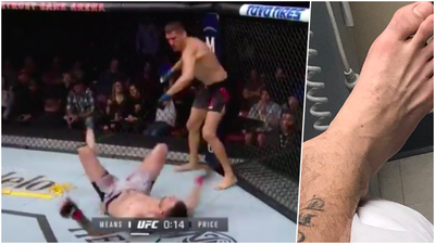 Tim Means suffers gruesome ankle injury after brutal knockout punch