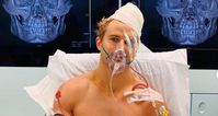 Sage Northcutt reveals multiple facial fractures after brutal knockout