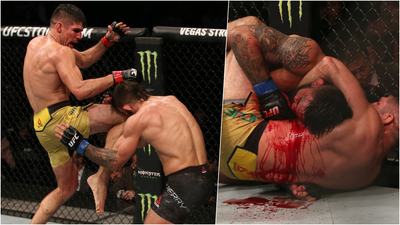 Mike Perry suffers horrific nose break after ‘Fight of the Night’ war