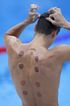 What are the dark circles on swimmers backs at Tokyo Olympics?