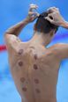 What are the dark circles on swimmers backs at Tokyo Olympics?