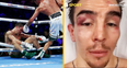 “It is what it is” – Michael Conlan shares uplifting update from hospital bed after sickening knock-out